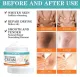 whitening cream for Private part and sensitive areas underarm